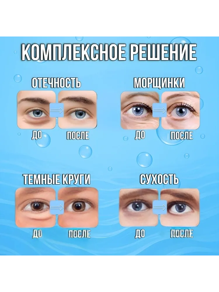 Патчи Buzz Lady гидрогелевые BZ612811011 от темных кругов 60 шт - фото 6